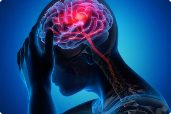 Brain Diseases